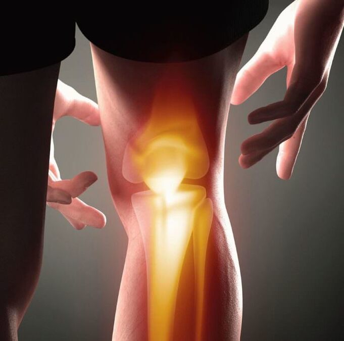 Wat is artritis en artrose